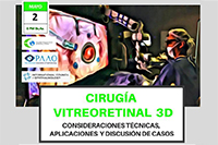 Cirugía Vitreoretinal 3D, 20 de abril